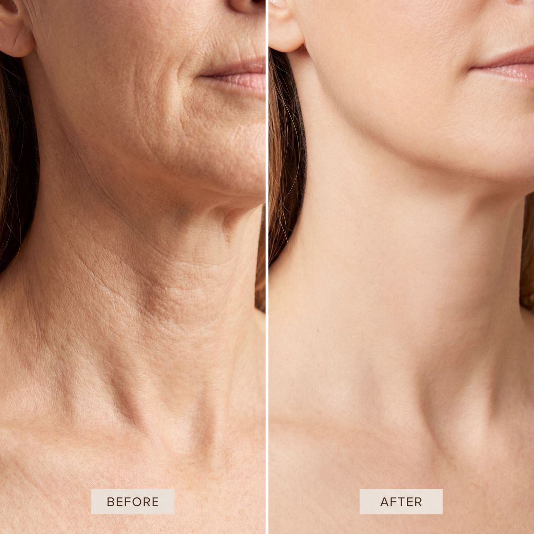 ✅Reverse-aging Adaptive Foundation: The Korean Pharmacy Secret to Younger-Looking Skin