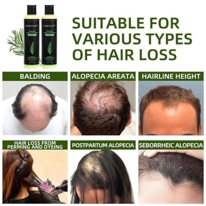 up🔥🌿Loftpromo® Organic Rosemary Hair Growth Shampoo