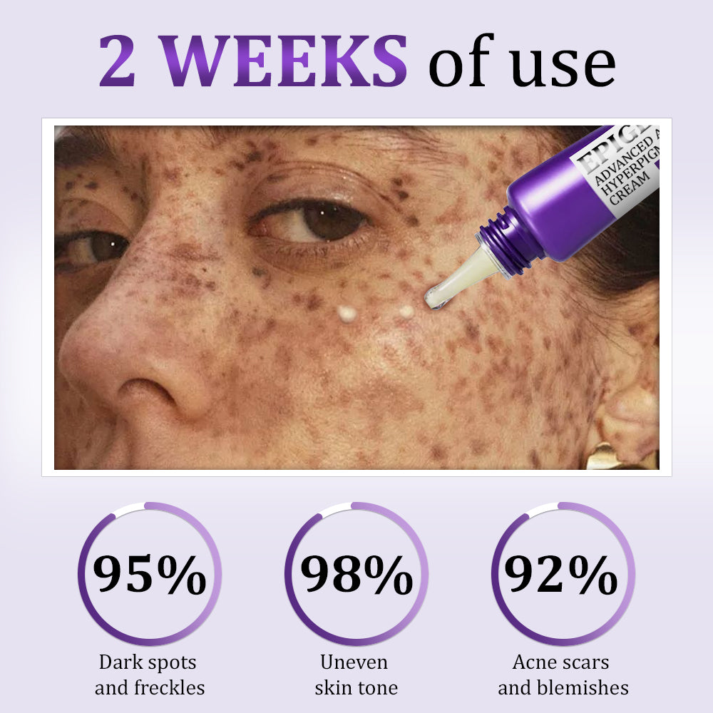 💜✅Loftpromo® EPIGLOW MelanEX: The Ultimate Dark Spot Eraser