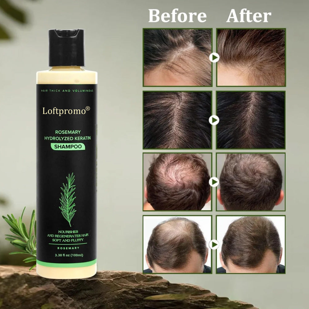 up🔥🌿Loftpromo® Organic Rosemary Hair Growth Shampoo