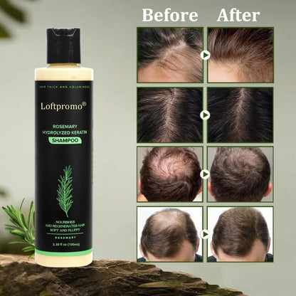 up🔥🌿Loftpromo® Organic Rosemary Hair Growth Shampoo